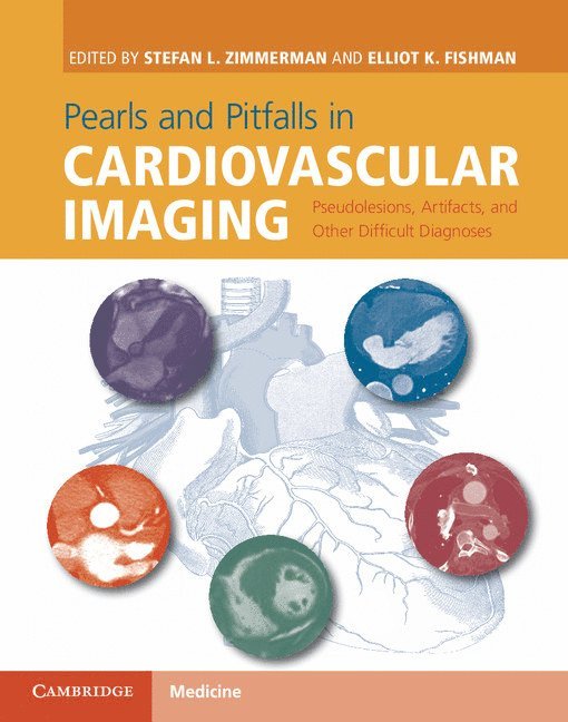 Pearls and Pitfalls in Cardiovascular Imaging