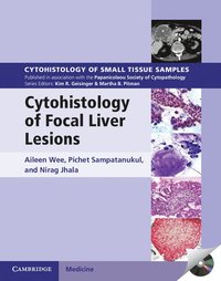 bokomslag Cytohistology of Focal Liver Lesions