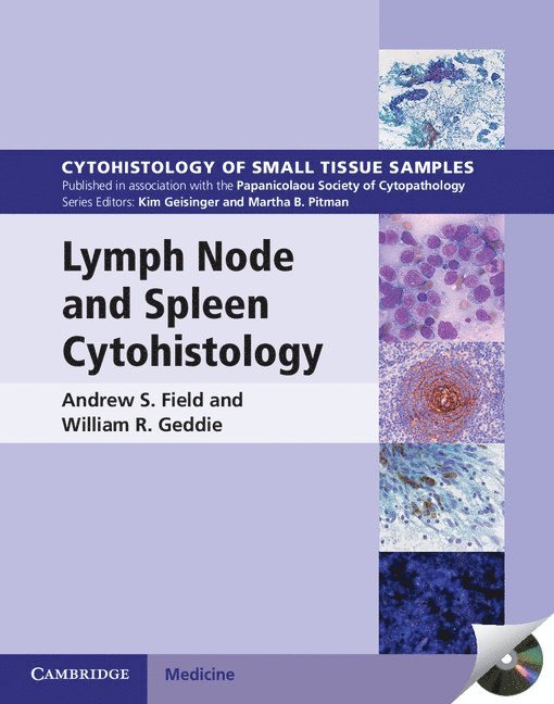Lymph Node and Spleen Cytohistology 1