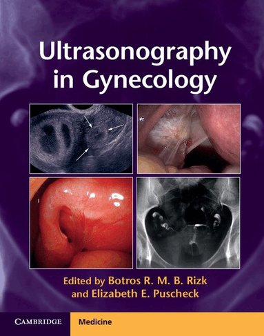 Botros R. M. B. Rizk, Elizabeth E. Puscheck - Ultrasonography in Gynecology, Inbunden