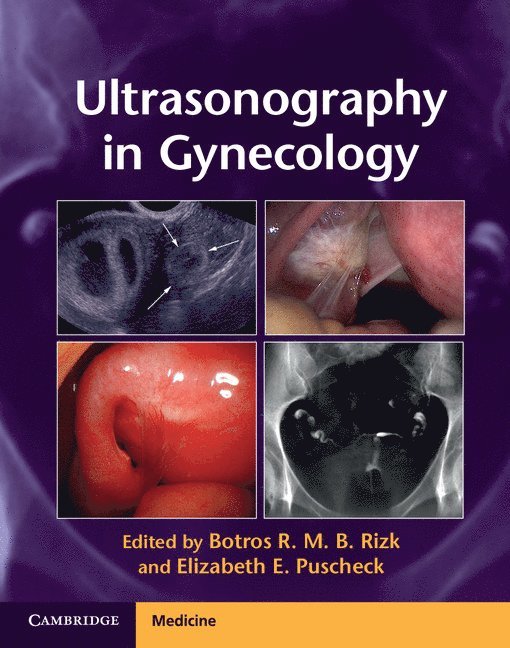 Ultrasonography in Gynecology