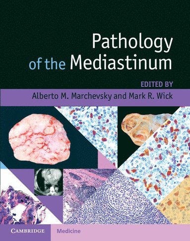 bokomslag Pathology of the Mediastinum