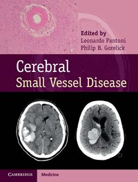 bokomslag Cerebral Small Vessel Disease