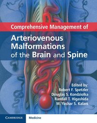 bokomslag Comprehensive Management of Arteriovenous Malformations of the Brain and Spine
