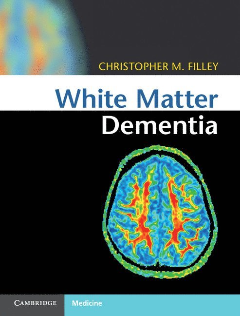 White Matter Dementia 1