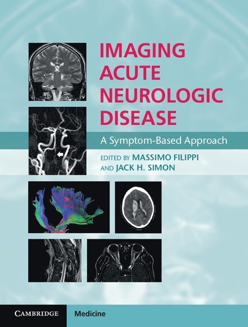 Imaging Acute Neurologic Disease 1