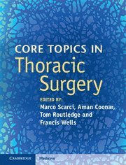 bokomslag Core Topics in Thoracic Surgery