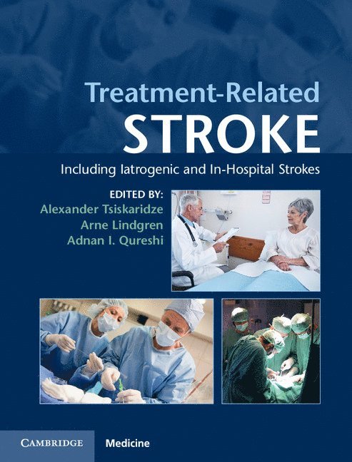 Treatment-Related Stroke 1