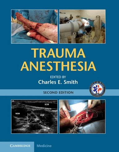 Charles E. Smith - Trauma Anesthesia, Inbunden