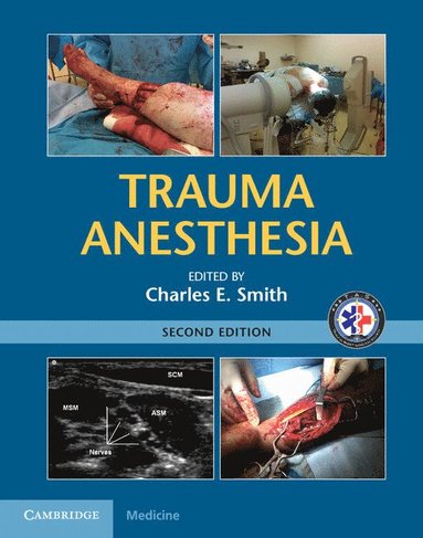 bokomslag Trauma Anesthesia