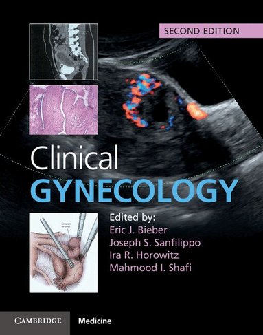 Eric J. Bieber, Joseph S. Sanfilippo, Ira R. Horowitz, Mahmood I. Shafi - Clinical Gynecology, Inbunden