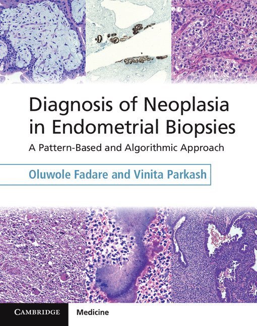 Diagnosis of Neoplasia in Endometrial Biopsies Book and Online Bundle 1