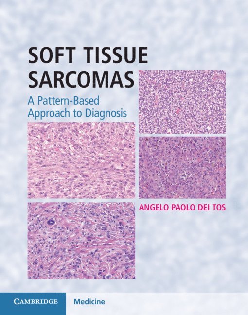 Soft Tissue Sarcomas Hardback with Online Resource 1