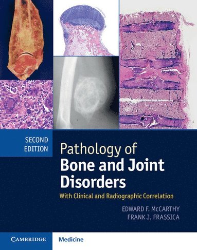 bokomslag Pathology of Bone and Joint Disorders Print and Online Bundle