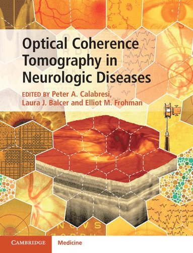 bokomslag Optical Coherence Tomography in Neurologic Diseases