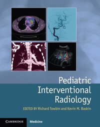 bokomslag Pediatric Interventional Radiology