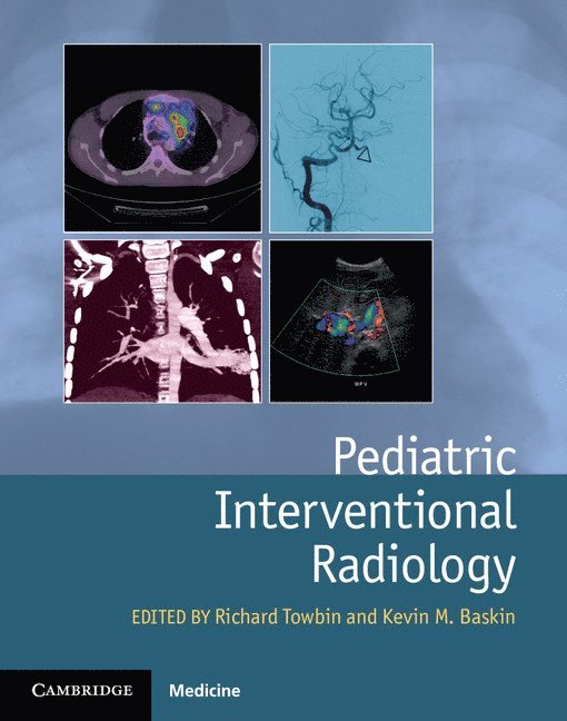 Pediatric Interventional Radiology 1