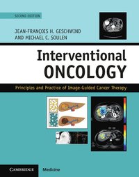 bokomslag Interventional Oncology