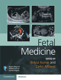 bokomslag Fetal Medicine