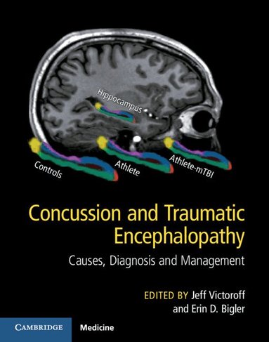 Jeff Victoroff, Erin D. Bigler - Concussion and Traumatic Encephalopathy, Inbunden
