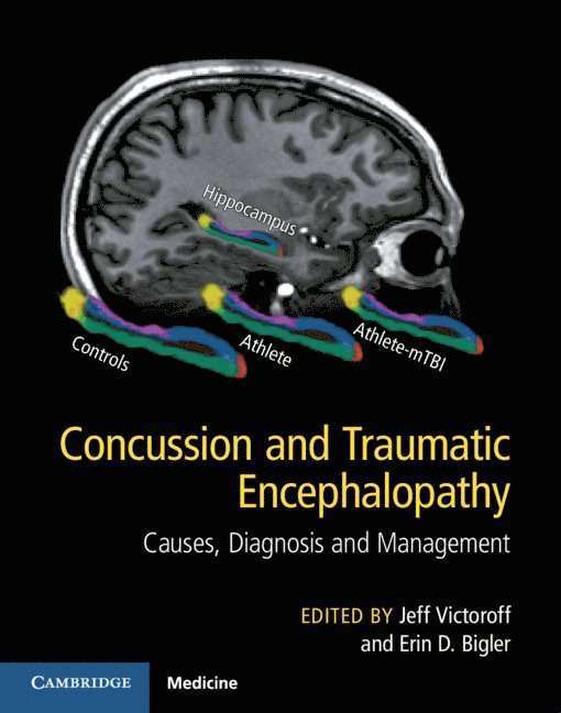 Concussion and Traumatic Encephalopathy 1