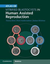 bokomslag Atlas of Vitrified Blastocysts in Human Assisted Reproduction