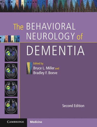 bokomslag The Behavioral Neurology of Dementia