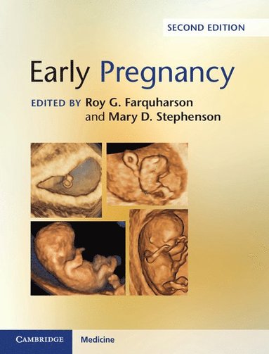 bokomslag Early Pregnancy