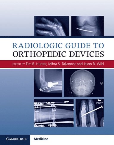 bokomslag Radiologic Guide to Orthopedic Devices