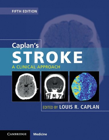 bokomslag Caplan's Stroke