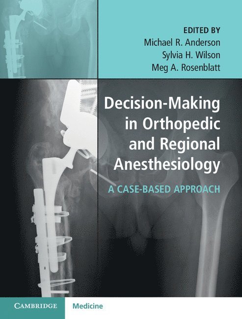 Michael R. Anderson, Sylvia H. Wilson, Meg A. Rosenblatt, Sylvia H. (Medical University of South Carolina) Wilson - Decision-Making in Orthopedic and Regional Anesthesiology, Inbunden