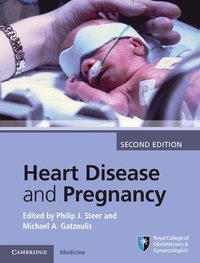 bokomslag Heart Disease and Pregnancy