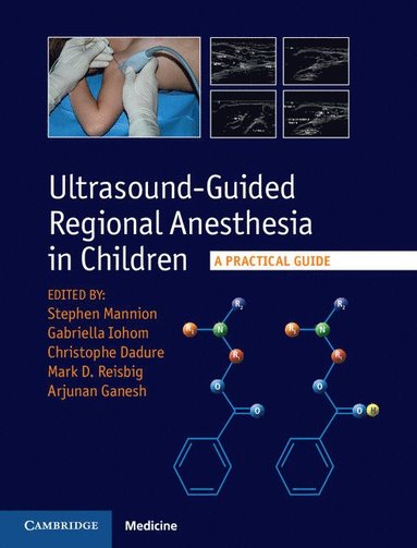 bokomslag Ultrasound-Guided Regional Anesthesia in Children