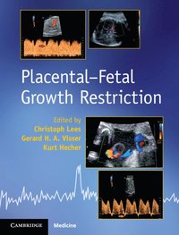 bokomslag Placental-Fetal Growth Restriction
