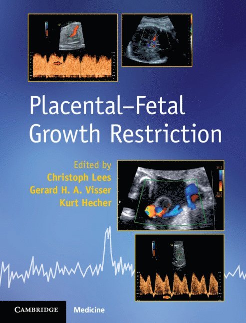 Placental-Fetal Growth Restriction 1