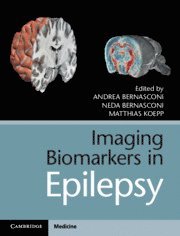 bokomslag Imaging Biomarkers in Epilepsy