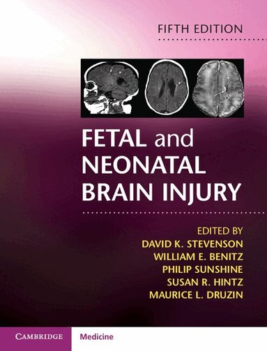 David K. Stevenson, William E. Benitz, Philip Sunshine, Susan R. Hintz, Maurice L. Druzin - Fetal and Neonatal Brain Injury, Inbunden