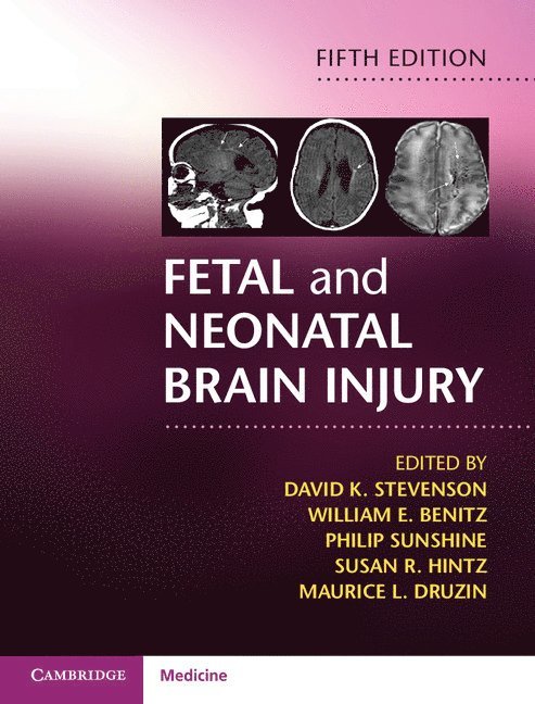 Fetal and Neonatal Brain Injury 1