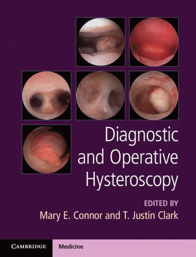 bokomslag Diagnostic and Operative Hysteroscopy
