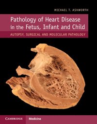 bokomslag Pathology of Heart Disease in the Fetus, Infant and Child