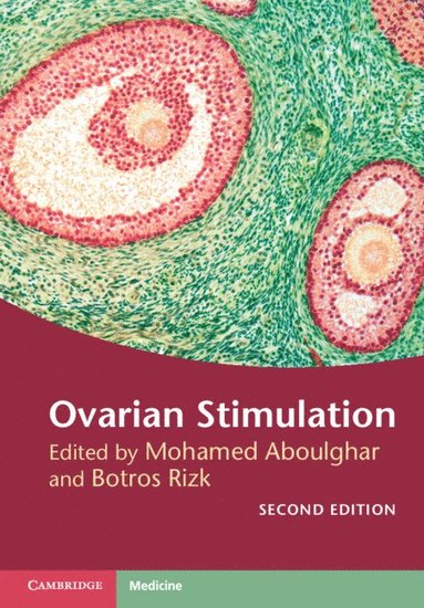 bokomslag Ovarian Stimulation