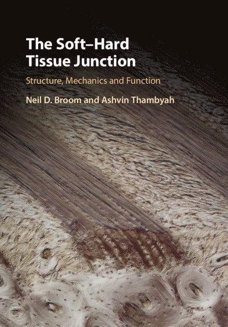 The Soft-Hard Tissue Junction 1