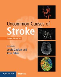 bokomslag Uncommon Causes of Stroke