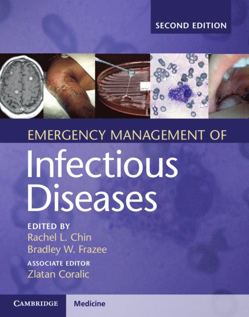 Emergency Management of Infectious Diseases 1