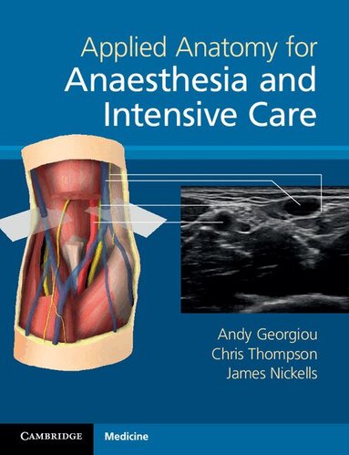 Andy Georgiou, Chris Thompson, James Nickells - Applied Anatomy for Anaesthesia and Intensive Care, Häftad