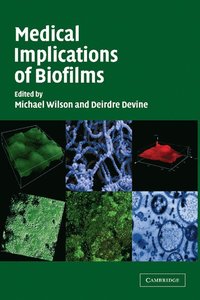 bokomslag Medical Implications of Biofilms