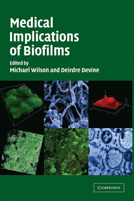 Medical Implications of Biofilms 1