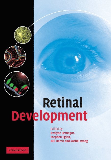 Evelyne Sernagor, Stephen Eglen, Bill Harris, Rachel Wong, Evelyne (University of Newcastle upon Tyne) Sernagor, Stephen (University of Cambridge) Eglen, Bill (University of Cambridge) Harris, St Louis) Wong, Rachel (Washington University - Retinal Development, Häftad