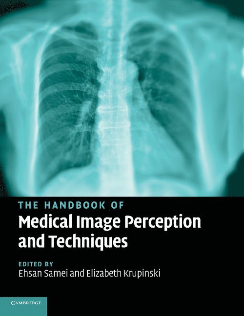 The Handbook of Medical Image Perception and Techniques 1