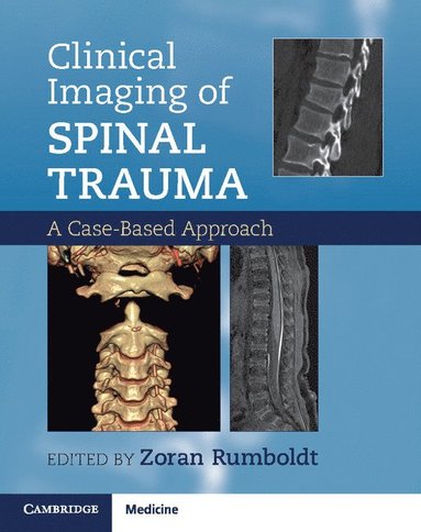 bokomslag Clinical Imaging of Spinal Trauma